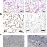Tle1 tumor suppressor negatively regulates inflammation in vivo and modulates NF-κB inflammatory pathway